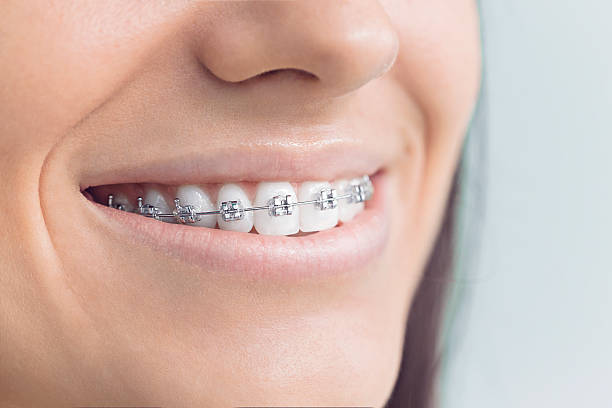 Dental Inlays and Onlays in Windber, PA
